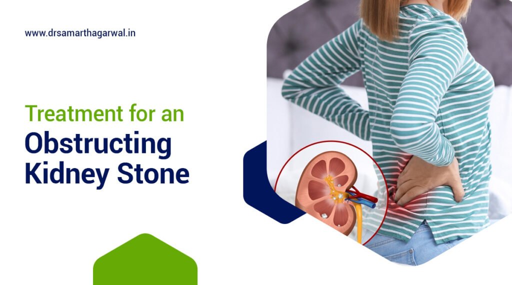 Obstructing Kidney Stone Treatment