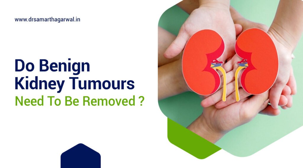 Do benign kidney tumors need to be removed