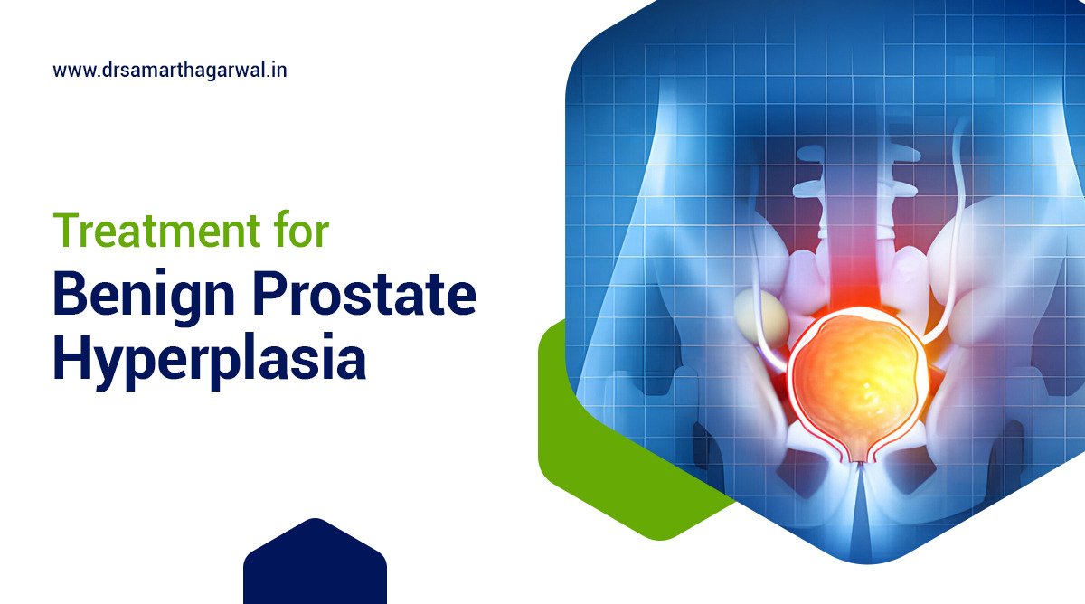 Benign Prostate Hyperplasia Treatment