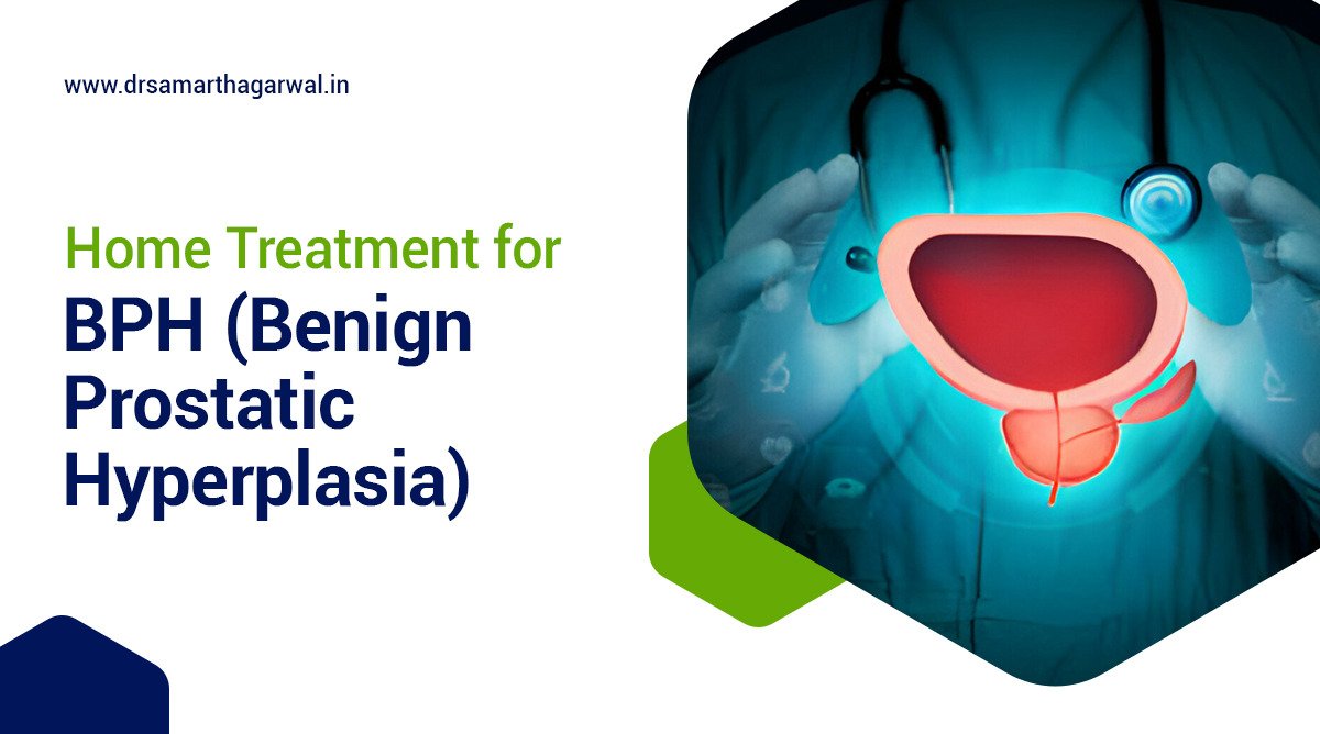 Home Treatment for BPH – Benign Prostatic Hyperplasia