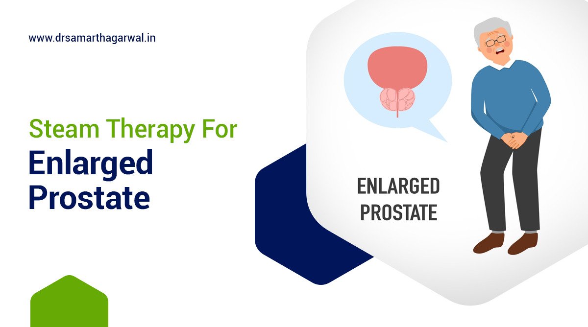 Steam Therapy for Enlarged Prostate