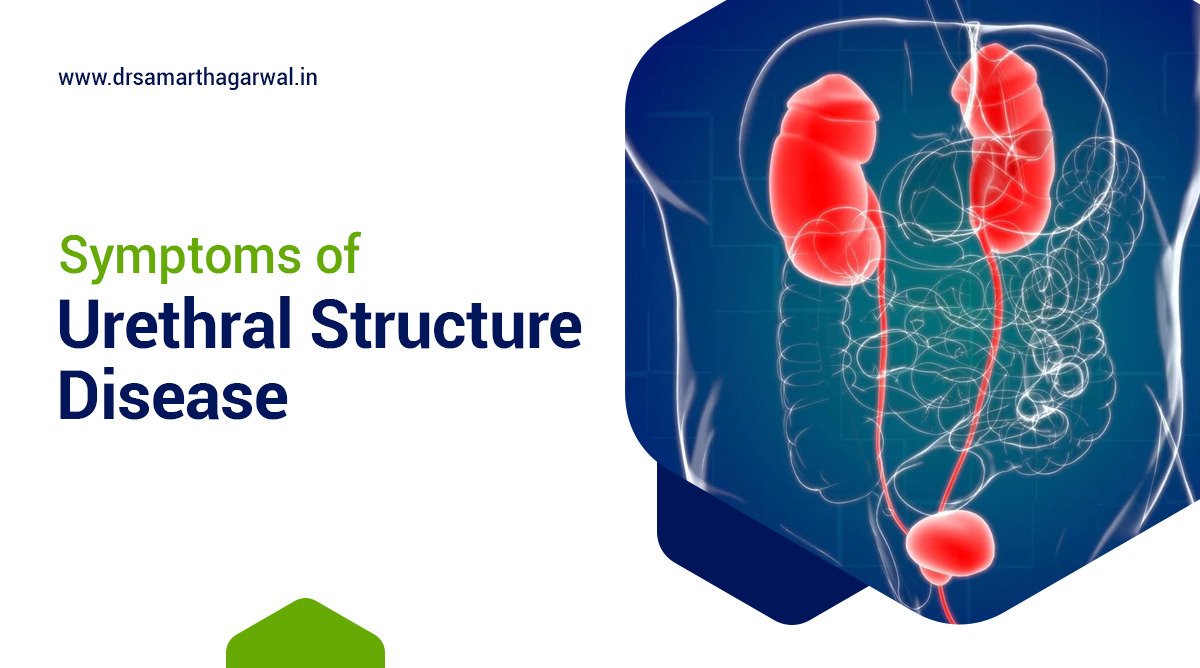 Urethral Stricture Disease Symptoms
