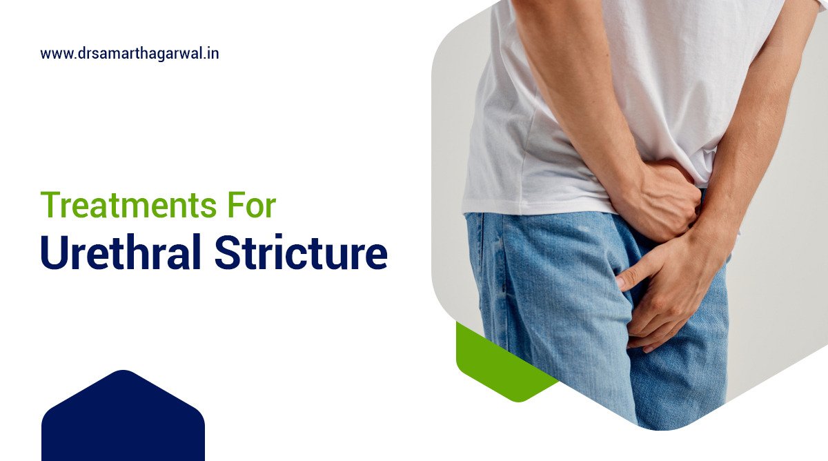 Urethral stricture Treatments