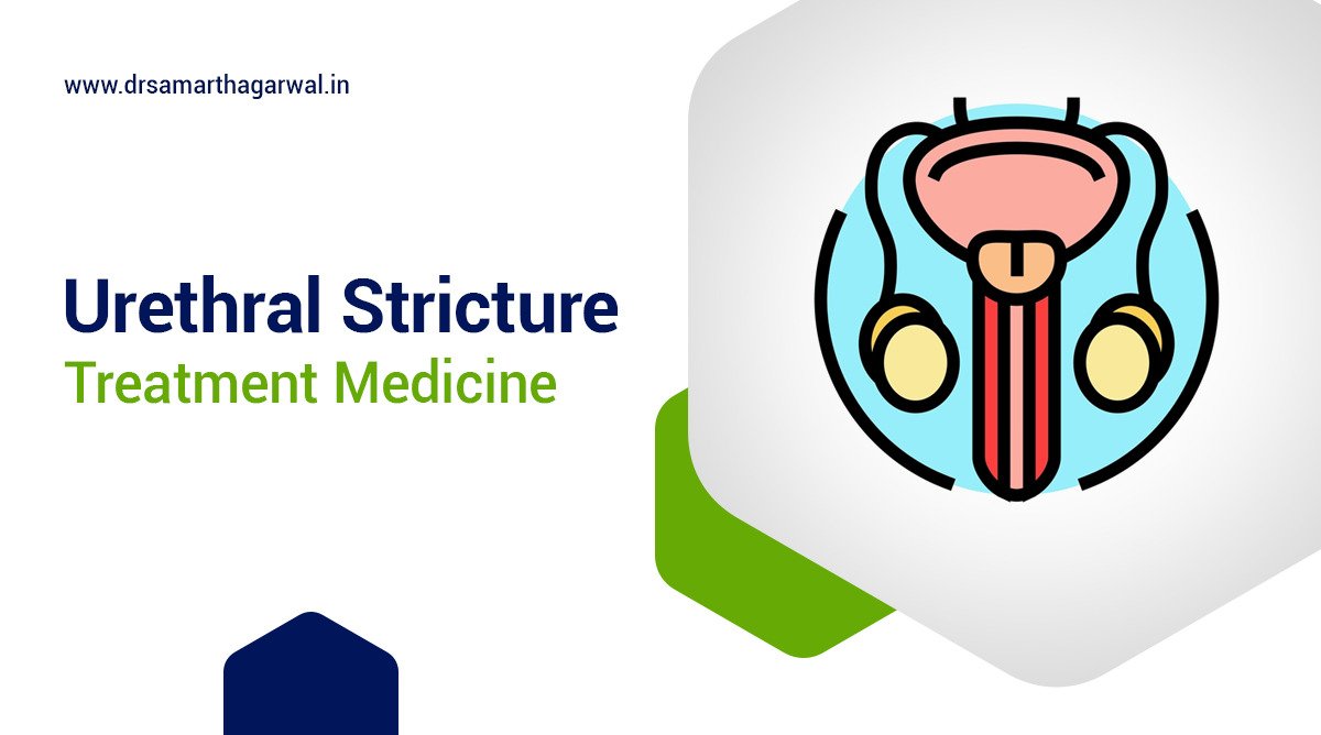 Can You Do Urethral Stricture Treatment with Medicine