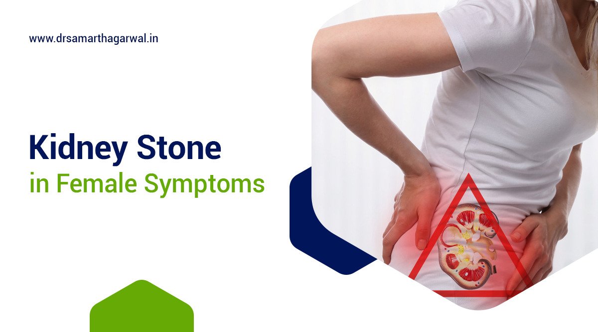Kidney Stone in Female Symptoms