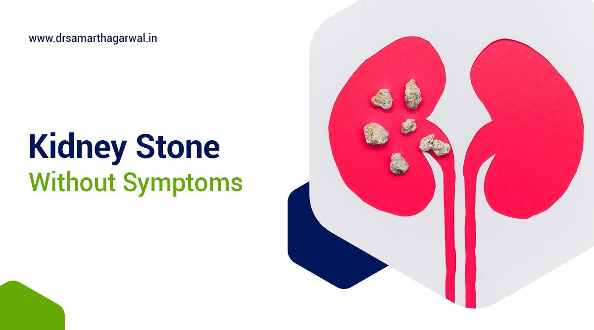 Can You Have Kidney Stones without Symptoms?