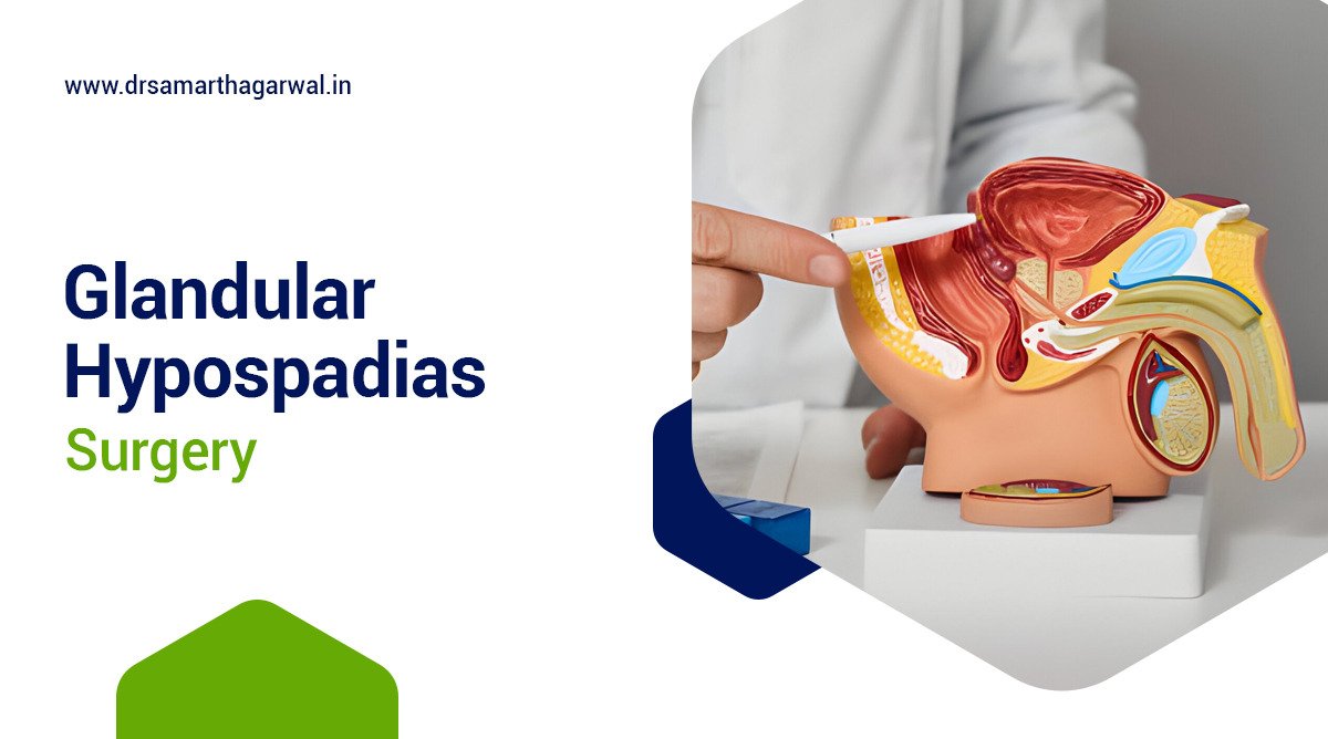 Glandular Hypospadias Surgery