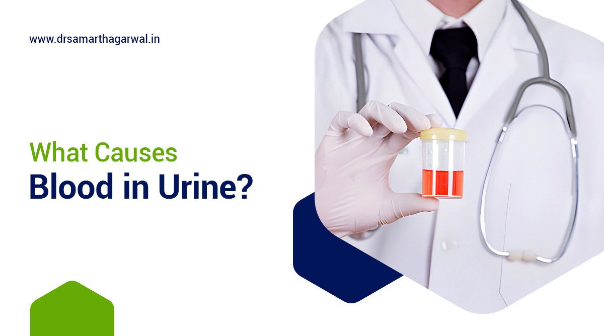 What causes blood in urine?