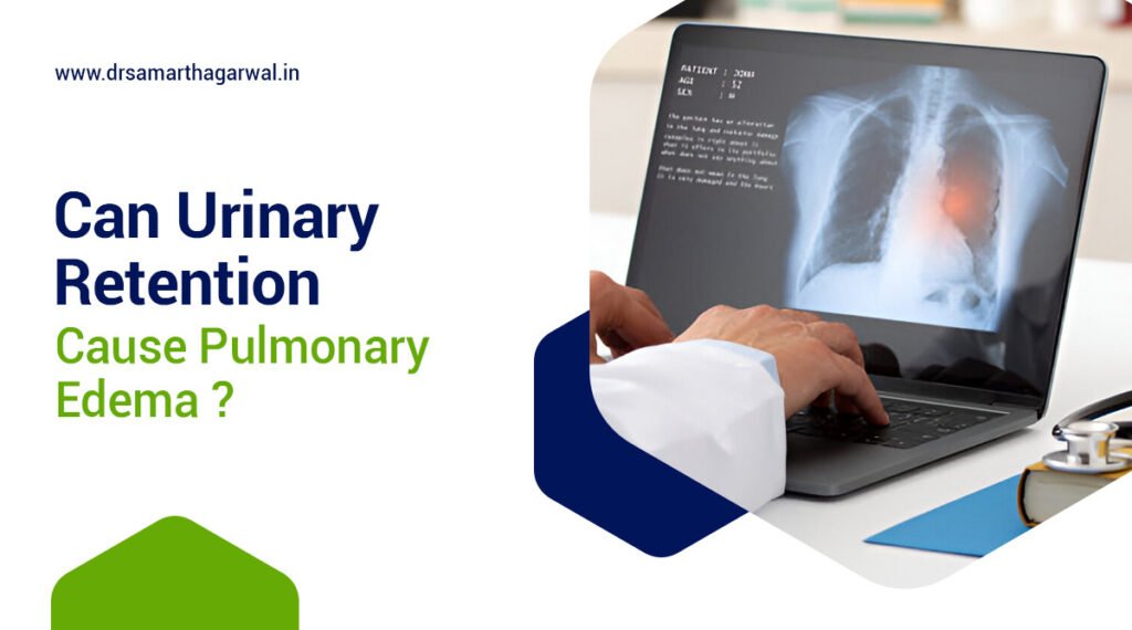 Can Urinary Retention Cause Pulmonary Edema?