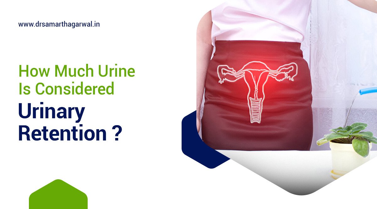 How Much Urine Is Considered Urinary Retention