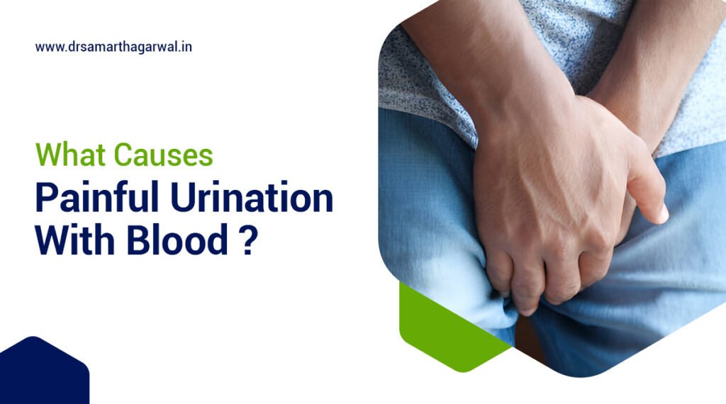 What Causes Painful Urination With Blood