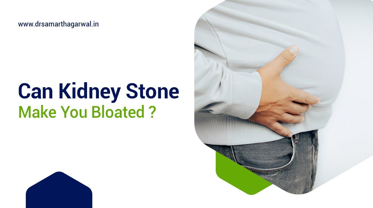 Can Kidney Stones Make You Bloated