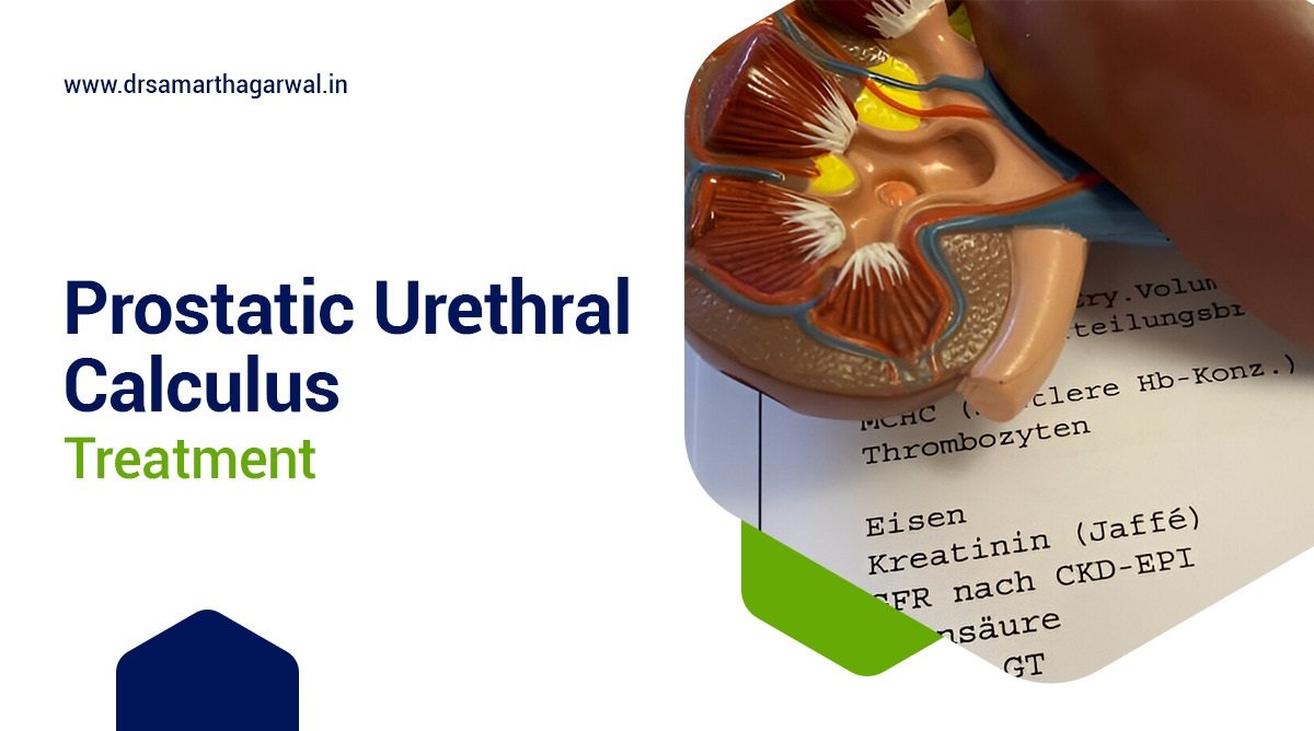 Prostatic Urethral Calculus Treatment