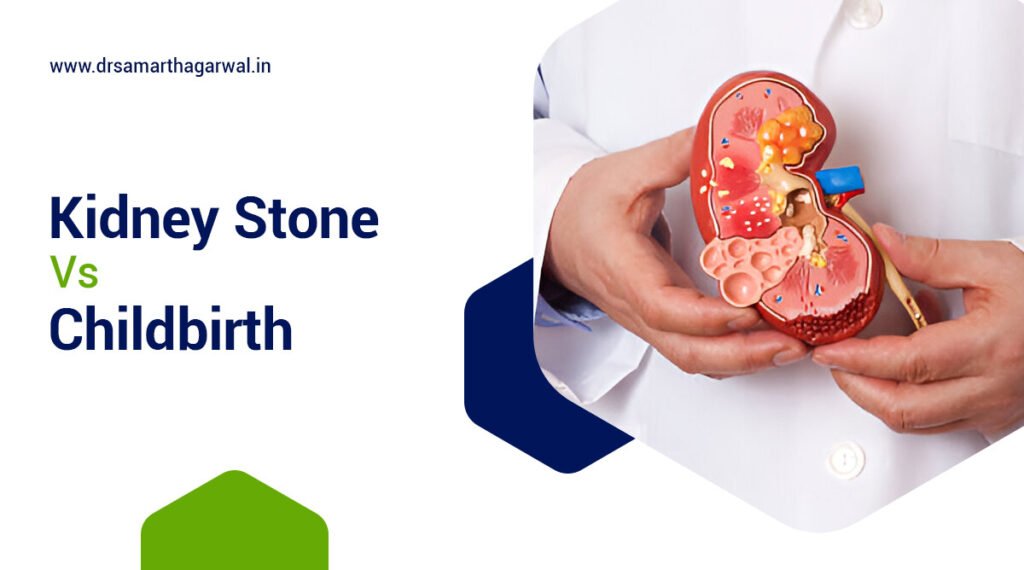 Kidney Stone vs Childbirth