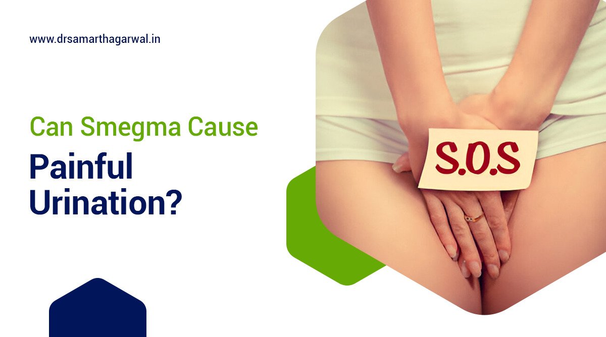 Can Smegma Cause Painful Urination?