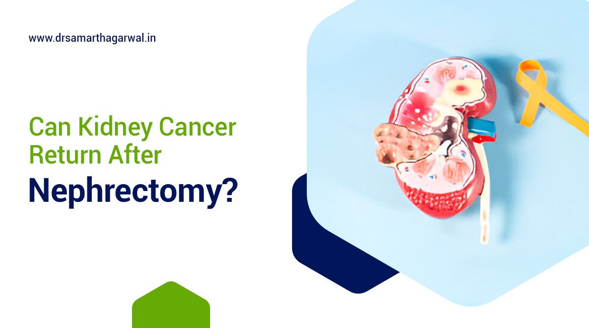 Can kidney cancer return after nephrectomy