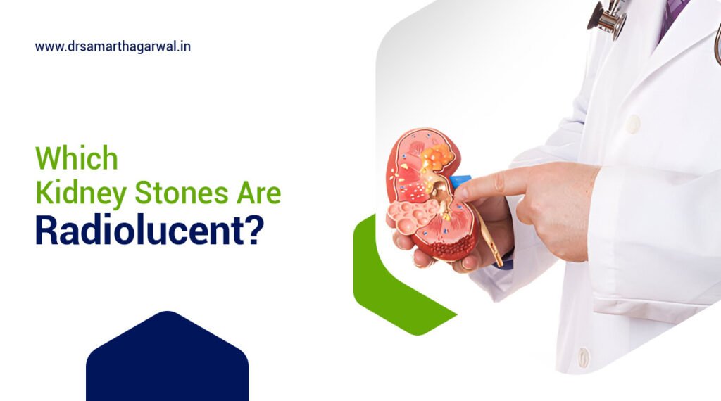 Which Kidney Stones Are Radiolucent